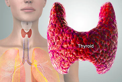 thyroid disease The Thyroid is a butterfly-shaped gland in the front of the neck